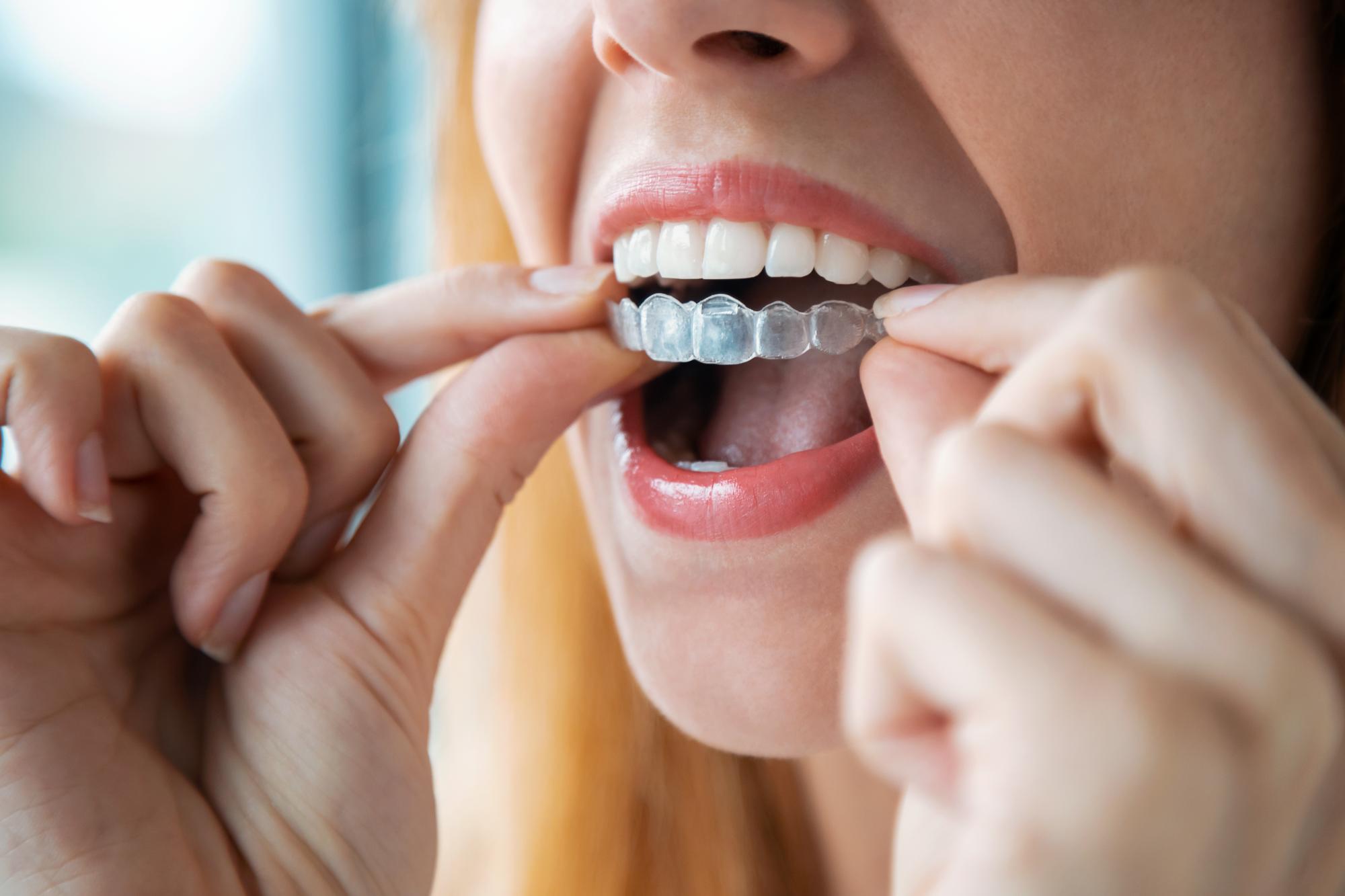 GettyImages-1226447065 orthodontist lincoln ne