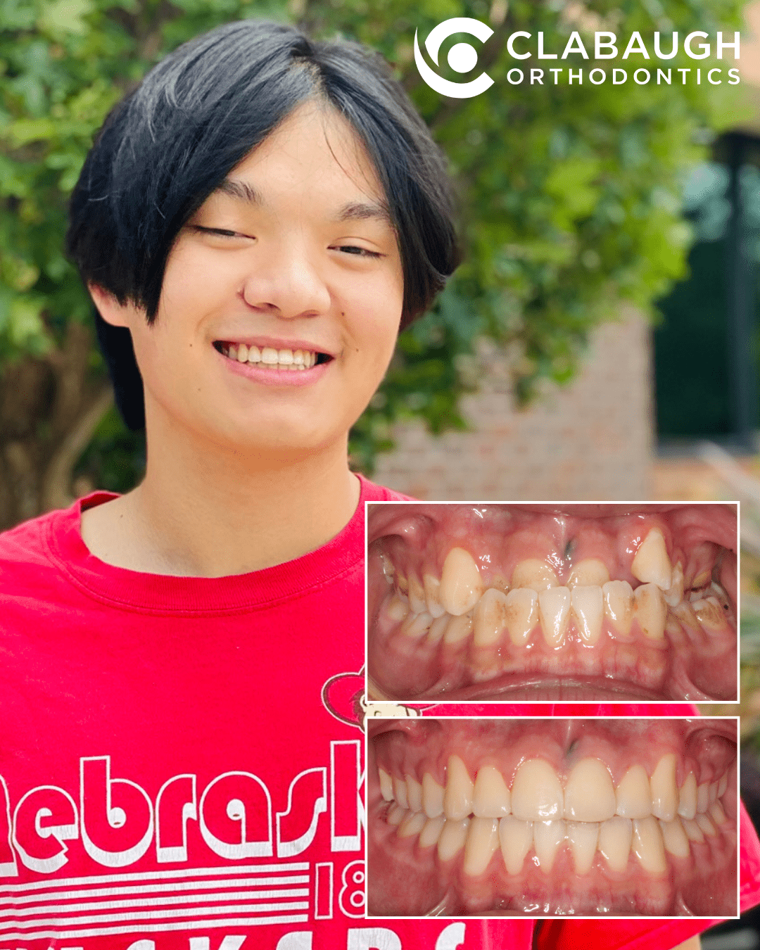 before & after