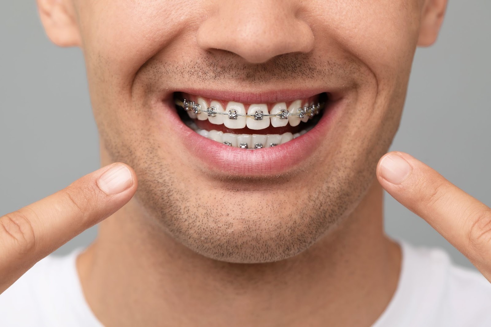 Orthodontic Treatment for Busy Adults in Lincoln